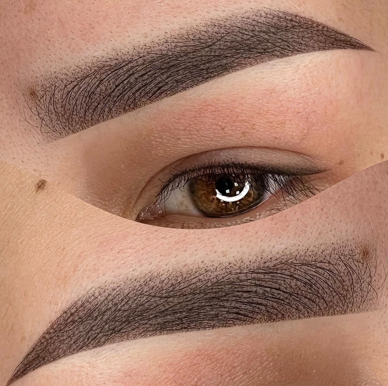 Cicatrização · traço natural · Luana Teixeira