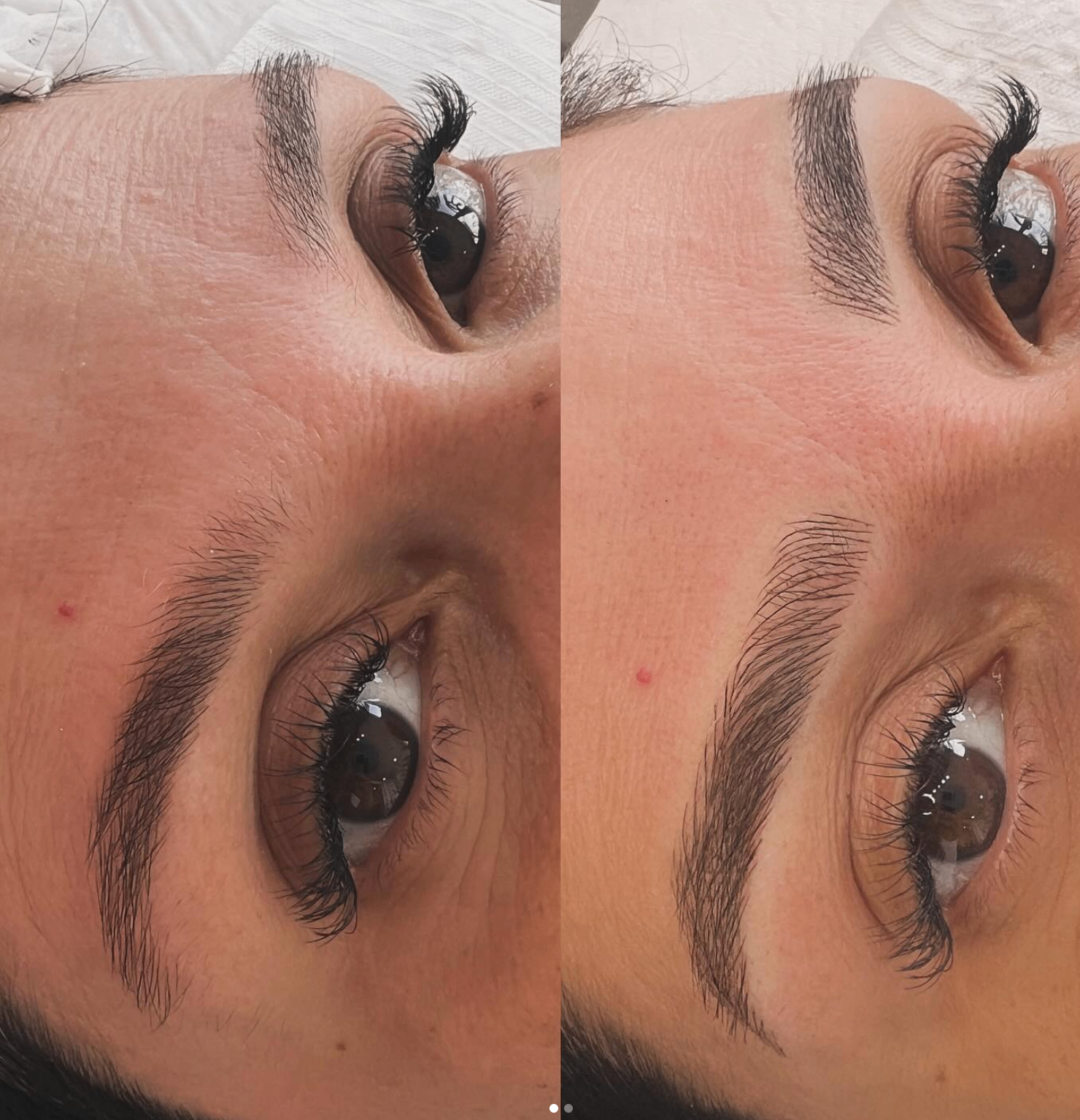 Antes e depois · fio a fio · Luana Teixeira
